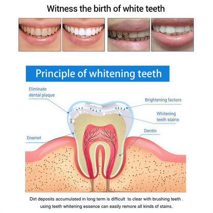 BUY 1 GET 1 FREE | Teeth Whitening Essence