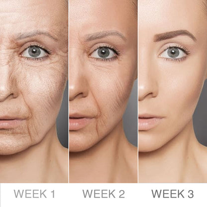 Elyvanle® Collagen Face Toner