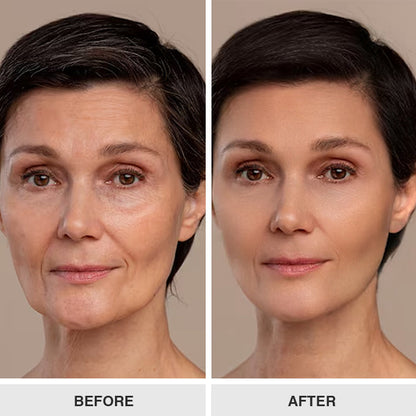 Elyvanle® Collagen Face Toner