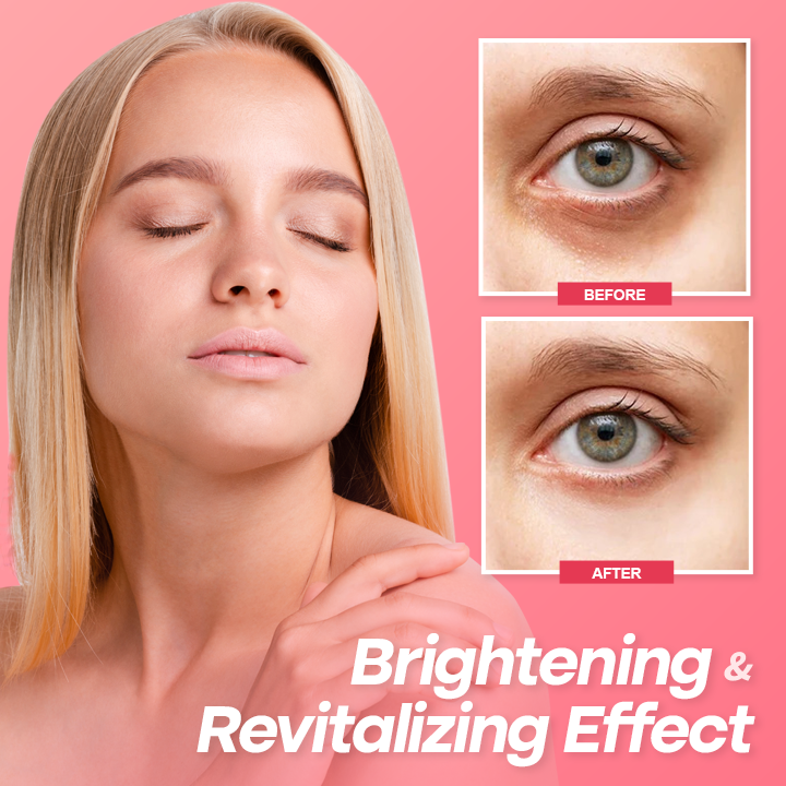 ⏰Limited Time Offer⏰Elyvanle® Retinol Eye Stick