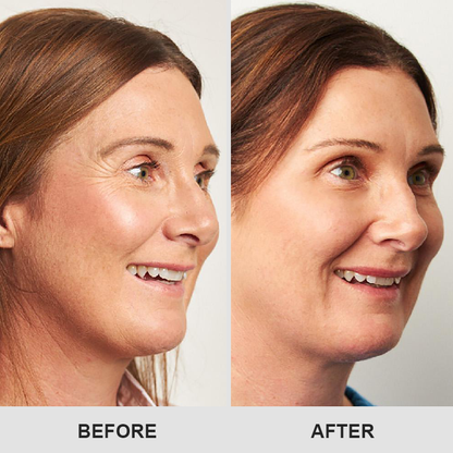 ⏰Limited Time Offer⏰Elyvanle® Retinol Eye Stick