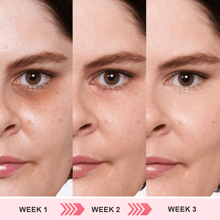 ⏰Limited Time Offer⏰Elyvanle® Retinol Eye Stick