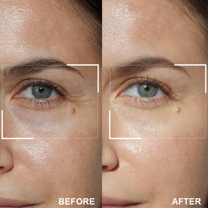 ⏰Limited Time Offer⏰Elyvanle® Retinol Eye Stick