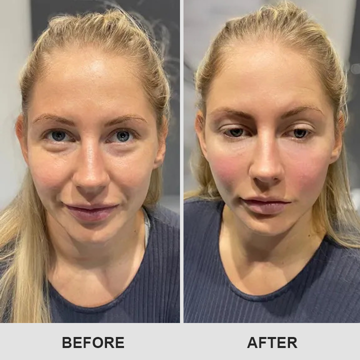 ⏰Limited Time Offer⏰Elyvanle® Retinol Eye Stick