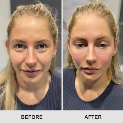 ⏰Limited Time Offer⏰Elyvanle® Retinol Eye Stick