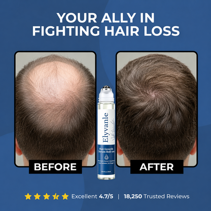 Elyvanle® Hair Growth Roll on Serum