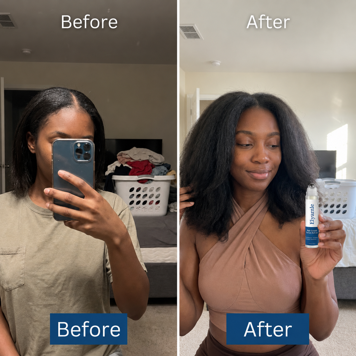 Elyvanle® Hair Growth Roll on Serum